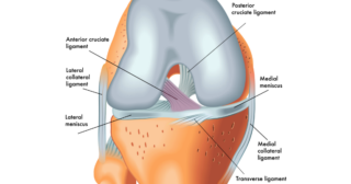 a medical diagram showing the parts of the knee, specifically the ACL